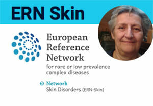 ERN skin ERN skin
