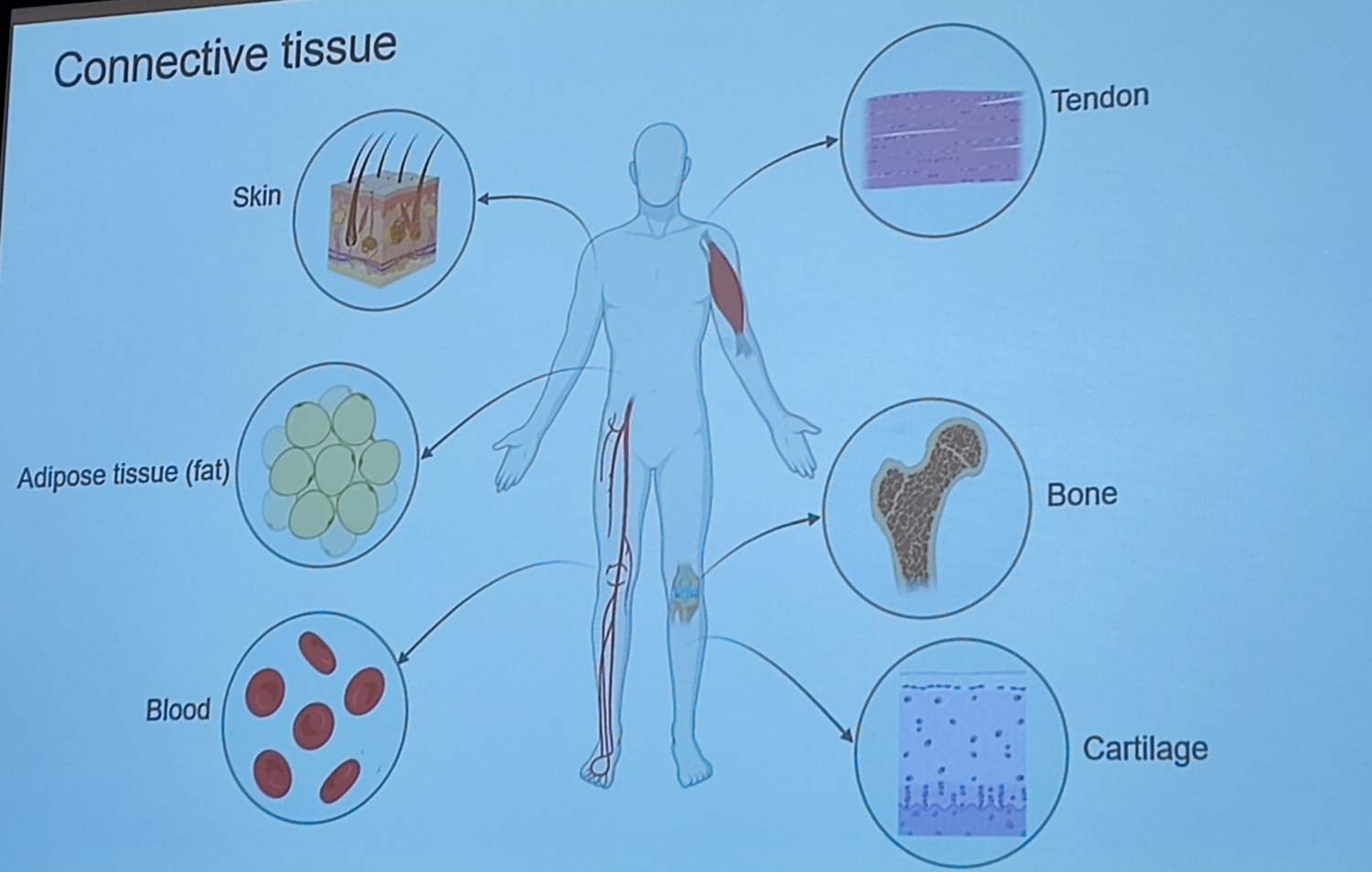 Mrs Aude Beyens, MD (Ghent, Belgium) Structural defects of Connective